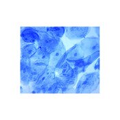 AFB Staining Kinyoun Kit